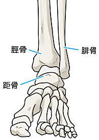 変形性足関節症