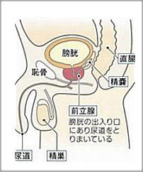 排尿困難