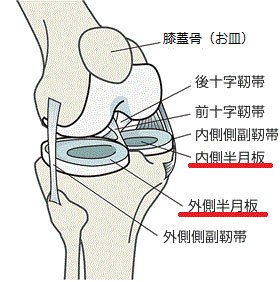 関節痛