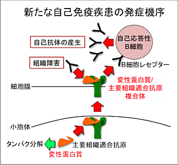 自己免疫疾患