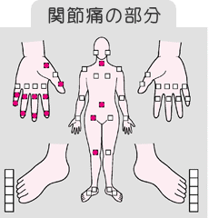 関節が痛い