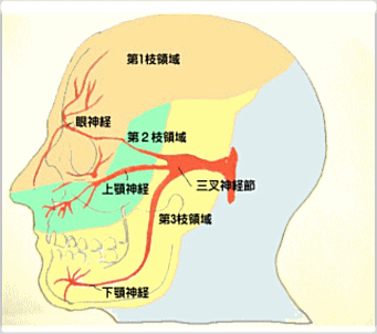 三叉神経痛