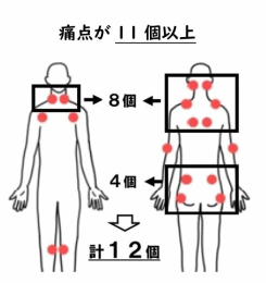 線維筋痛症