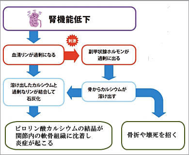 石灰化症（偽痛風）